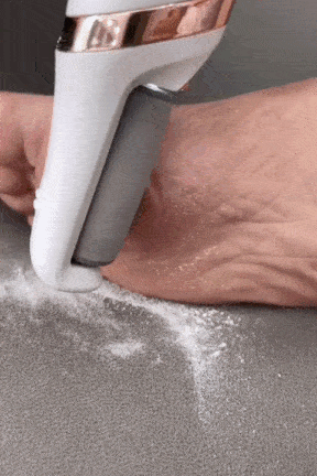 Electric Pedicure Foot File Callus Remover – Rechargeable Foot Care Device for Smooth Heels – UAE